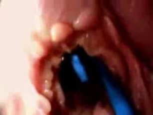 penis camera